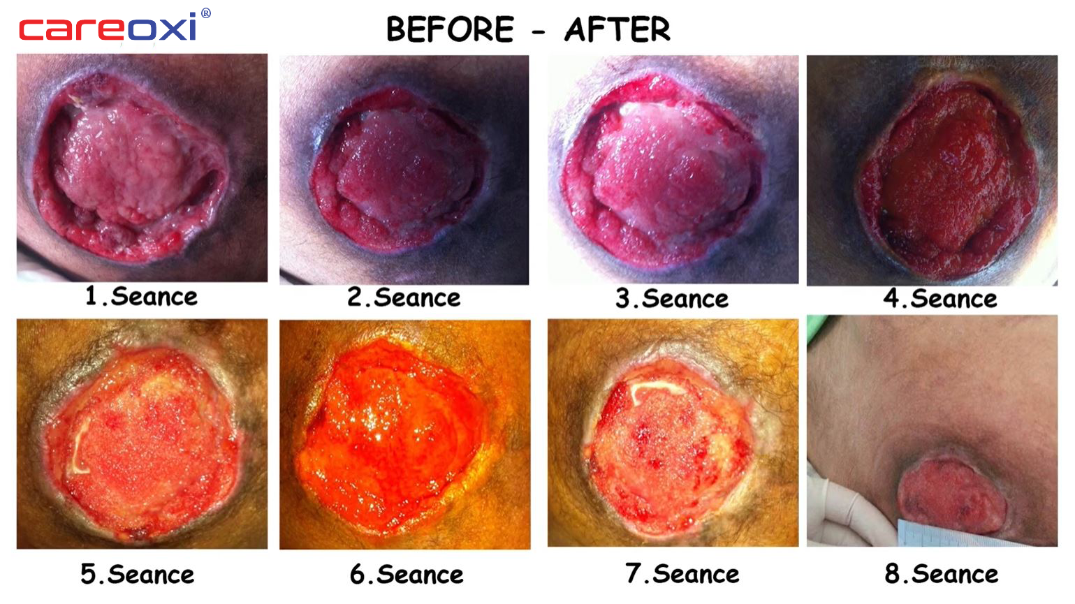 wound treatment case results